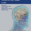 Neurosurgery Tricks of the Trade – Cranial 1st edition Edition Neurosurgery Tricks of the Trade – Cranial 1st edition Edition