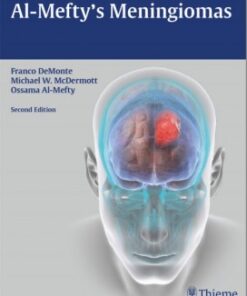 Al-Mefty’s Meningiomas 2nd Edition
