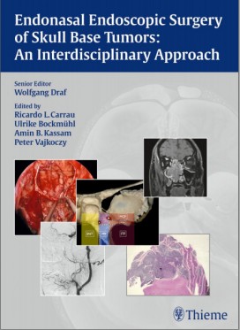 Endonasal Endoscopic Surgery of Skull Base Tumors: An Interdisciplinary Approach 1st Edition Endonasal Endoscopic Surgery of Skull Base Tumors: An Interdisciplinary Approach 1st Edition