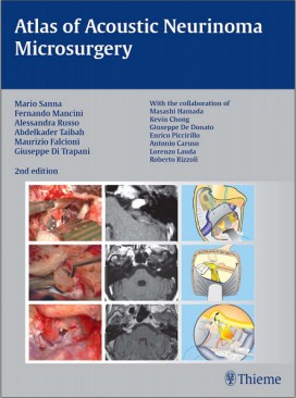 Atlas of Acoustic Neurinoma Microsurgery 2nd edition Atlas of Acoustic Neurinoma Microsurgery 2nd edition