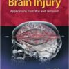 Brain Injury: Applications from War and Terrorism 1st Edition Brain Injury: Applications from War and Terrorism 1st Edition
