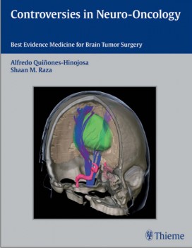 Controversies in Neuro-Oncology: Best Evidence Medicine for Brain Tumor Surgery 1st Edition Controversies in Neuro-Oncology: Best Evidence Medicine for Brain Tumor Surgery 1st Edition