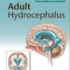 Adult Hydrocephalus 1st Edition