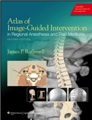 Atlas of Image-Guided Intervention in Regional Anesthesia and Pain Medicine, 2nd Edition Atlas of Image-Guided Intervention in Regional Anesthesia and Pain Medicine, 2nd Edition
