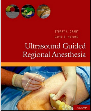 Ultrasound Guided Regional Anesthesia Ultrasound Guided Regional Anesthesia
