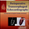 Perioperative Transesophageal Echocardiography: A Companion to Kaplan’s Cardiac Anesthesia Perioperative Transesophageal Echocardiography: A Companion to Kaplan’s Cardiac Anesthesia