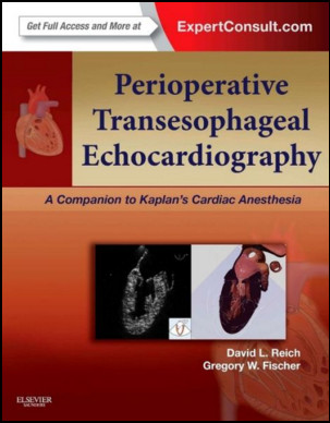 Perioperative Transesophageal Echocardiography: A Companion to Kaplan’s Cardiac Anesthesia Perioperative Transesophageal Echocardiography: A Companion to Kaplan’s Cardiac Anesthesia