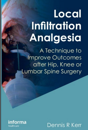 Local Infiltration Analgesia: A Technique to Improve Outcomes after Hip, Knee or Lumbar Spine Surgery Local Infiltration Analgesia: A Technique to Improve Outcomes after Hip, Knee or Lumbar Spine Surgery