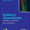 Epidural Anaesthesia: Images, Problems and Solutions Epidural Anaesthesia: Images, Problems and Solutions