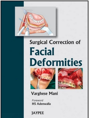 Surgical Correction of Facial Deformities Surgical Correction of Facial Deformities