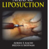 Atlas of Liposuction Atlas of Liposuction