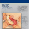 Intracranial Aneurysm Surgery: Basic Principles and Techniques Intracranial Aneurysm Surgery: Basic Principles and Techniques