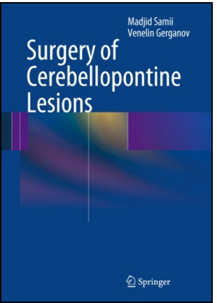 Surgery of Cerebellopontine Lesions Surgery of Cerebellopontine Lesions