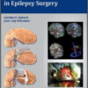 Operative Techniques in Epilepsy Surgery Operative Techniques in Epilepsy Surgery