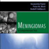 Meningiomas: A Comprehensive Text Expert Consult – Online and Print Meningiomas: A Comprehensive Text Expert Consult – Online and Print