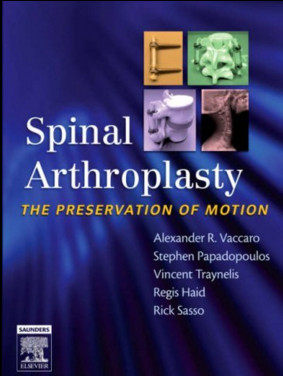 Spinal Arthroplasty : The Preservation of Motion Spinal Arthroplasty : The Preservation of Motion