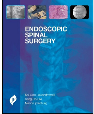 Endoscopic Spinal Surgery Endoscopic Spinal Surgery
