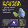 Image-Guided Hypofractionated Stereotactic Radiosurgery : A Practical Approach to Guide Treatment of Brain and Spine Tumors Image-Guided Hypofractionated Stereotactic Radiosurgery : A Practical Approach to Guide Treatment of Brain and Spine Tumors