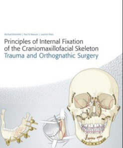 Principles of Internal Fixation of the Craniomaxillofacial Skeleton: Trauma and Orthognathic Surgery