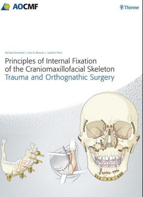 Principles of Internal Fixation of the Craniomaxillofacial Skeleton: Trauma and Orthognathic Surgery Principles of Internal Fixation of the Craniomaxillofacial Skeleton: Trauma and Orthognathic Surgery