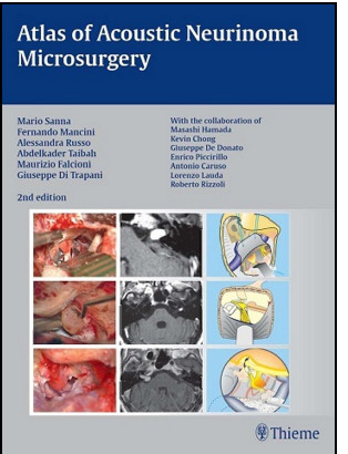 Atlas of Acoustic Neurinoma Microsurgery, 2nd Edition Atlas of Acoustic Neurinoma Microsurgery, 2nd Edition