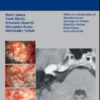 The Facial Nerve in Temporal Bone and Lateral Skull Base Microsurgery The Facial Nerve in Temporal Bone and Lateral Skull Base Microsurgery