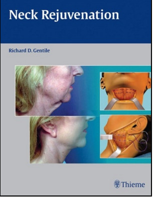 Neck Rejuvenation Neck Rejuvenation