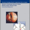 Minimally Invasive Endonasal Sinus Surgery: Principles, Techniques, Results, Complications, Revision Surgery Minimally Invasive Endonasal Sinus Surgery: Principles, Techniques, Results, Complications, Revision Surgery