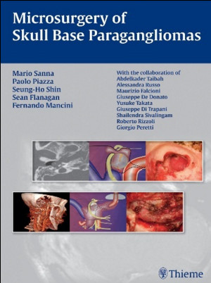 Microsurgery of Skull Base Paragangliomas Microsurgery of Skull Base Paragangliomas