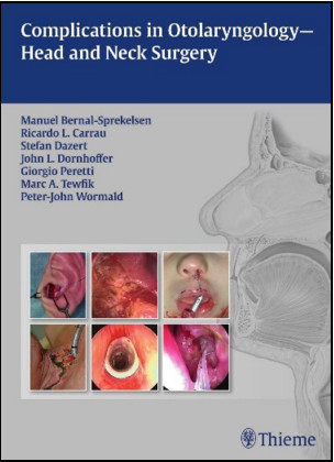 Complications in Otolaryngology-Head and Neck Surgery Complications in Otolaryngology-Head and Neck Surgery