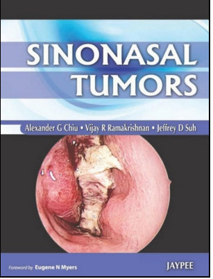 Sinonasal Tumors Sinonasal Tumors