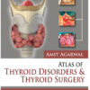 Atlas of Thyroid Disorders and Thyroid Surgery Atlas of Thyroid Disorders and Thyroid Surgery