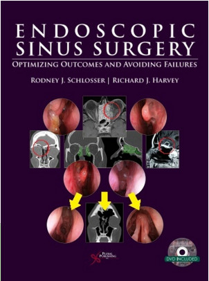 Endoscopic Sinus Surgery: Optimizing Outcomes and Avoiding Failures Endoscopic Sinus Surgery: Optimizing Outcomes and Avoiding Failures