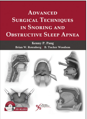 Advanced Surgical Techniques in Snoring and Obstructive Sleep Apnea Advanced Surgical Techniques in Snoring and Obstructive Sleep Apnea