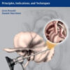 Endoscopic Ear Surgery: Principles, Indications, and Techniques Endoscopic Ear Surgery: Principles, Indications, and Techniques