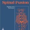 Spinal Fusion: Science and Technique Spinal Fusion: Science and Technique