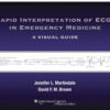 Rapid Interpretation of ECGs in Emergency Medicine: A Visual Guide Rapid Interpretation of ECGs in Emergency Medicine: A Visual Guide