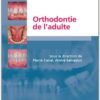 L’implantologie non enfouie (French Edition)