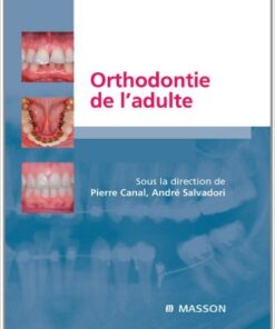 L’implantologie non enfouie (French Edition)