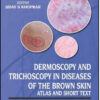 Dermoscopy and Trichoscopy in Diseases of the Brown Skin: Atlas and Short Text Dermoscopy and Trichoscopy in Diseases of the Brown Skin: Atlas and Short Text