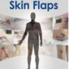 Making Decisions and Avoiding Complications in Skin Flaps Making Decisions and Avoiding Complications in Skin Flaps