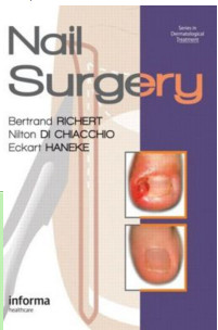 Nail Surgery Nail Surgery