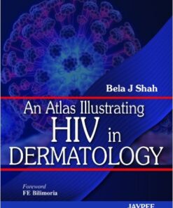An Atlas Illustrating HIV in Dermatology