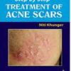 Step by Step® Treatment of Acne Scars