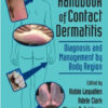 Clinical Handbook of Contact Dermatitis: Diagnosis and Management by Body Region Clinical Handbook of Contact Dermatitis: Diagnosis and Management by Body Region