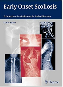 Early Onset Scoliosis: A Comprehensive Guide from the Oxford Meetings 1st edition Edition Early Onset Scoliosis: A Comprehensive Guide from the Oxford Meetings 1st edition Edition