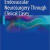 Endovascular Neurosurgery Through Clinical Cases 2015th Edition Endovascular Neurosurgery Through Clinical Cases 2015th Edition