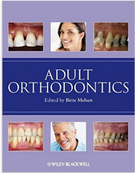 Adult Orthodontics 1st Edition Adult Orthodontics 1st Edition