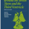 Surgery in and around the Brain Stem and the Third Ventricle: Anatomy · Pathology · Neurophysiology Diagnosis · Treatment Surgery in and around the Brain Stem and the Third Ventricle: Anatomy · Pathology · Neurophysiology Diagnosis · Treatment