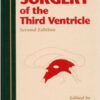 Surgery of the Third Ventricle Second Edition Surgery of the Third Ventricle Second Edition